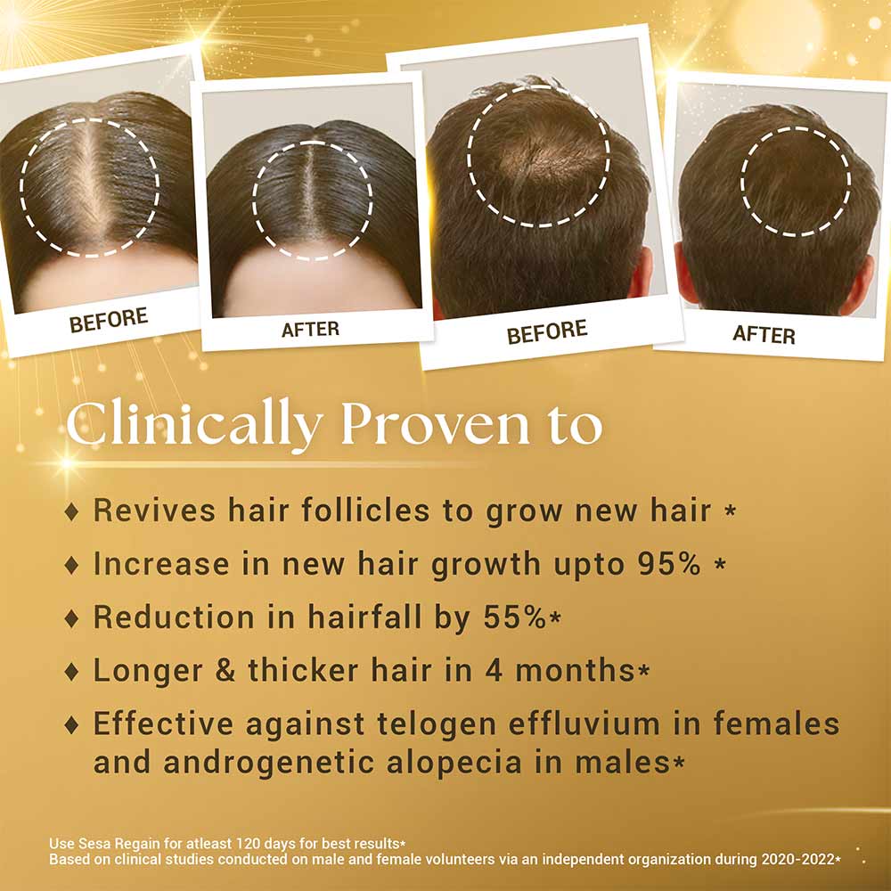 5 - Sesa Regain Hair Growth Oil,  100 ml  Made With Kshir Pak Vidhi (Refill Pack) 