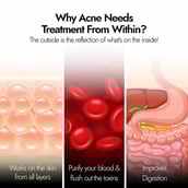 4 - Kapiva Skin Foods Acne Ease Fizz Flavour Orange,  20 tablet(s) 