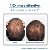 5 - HealthKart HK Vitals Headful Growth+ Serum,  30 ml  All Hair Type