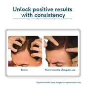 4 - HealthKart HK Vitals Headful Growth Serum,  30 ml  All Hair Type