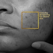 2 - VLCC Clinic Skin Clarifying De-Tan Face Wash,  150 ml  Glycolic Acid & Vitamin C