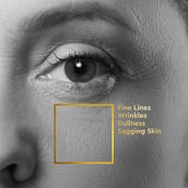 2 - VLCC Clinic Cellulosic Peeling Face Scrub, 100 ml Cellulose + Glycolic Acid + Niacinamide