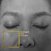 7 - VLCC Clinic ProRescue Micro Serum,  30 ml  5XCellRescue Complex