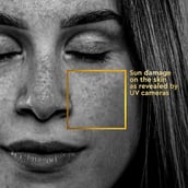 7 - VLCC Clinic ProDefence DeTan Sun Screen Gel Creme,  100 g  SPF 50 PA+++