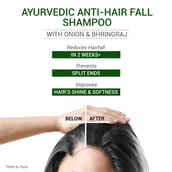 2 - Sesa Ayurvedic Anti-Hair Fall Shampoo, 1 L With Bhringraj & Onion