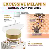 4 - myUpchar Ayurveda Brightening & Whitening Body Cream, 50 g for Dark Patches