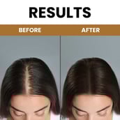 4 - myUpchar Ayurveda Kesh Art Bhringraj Shampoo, 200 ml Anti-Hairfall