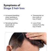 3 - HealthKart HK Vital Hair Fall Solution Kit, STAGE 2