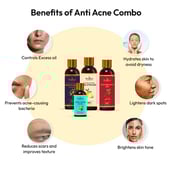 2 - Roopayur Anti Acne Combo,  4 Piece(s)/Pack  Anti Acne & Anti Spot Face Wash + Skin Healing Gel + Anti Acne Serum + Moisturizer Sunscreen 