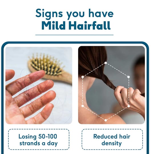 4 - HK Vitals Female Hair Fall Solution,  Mild